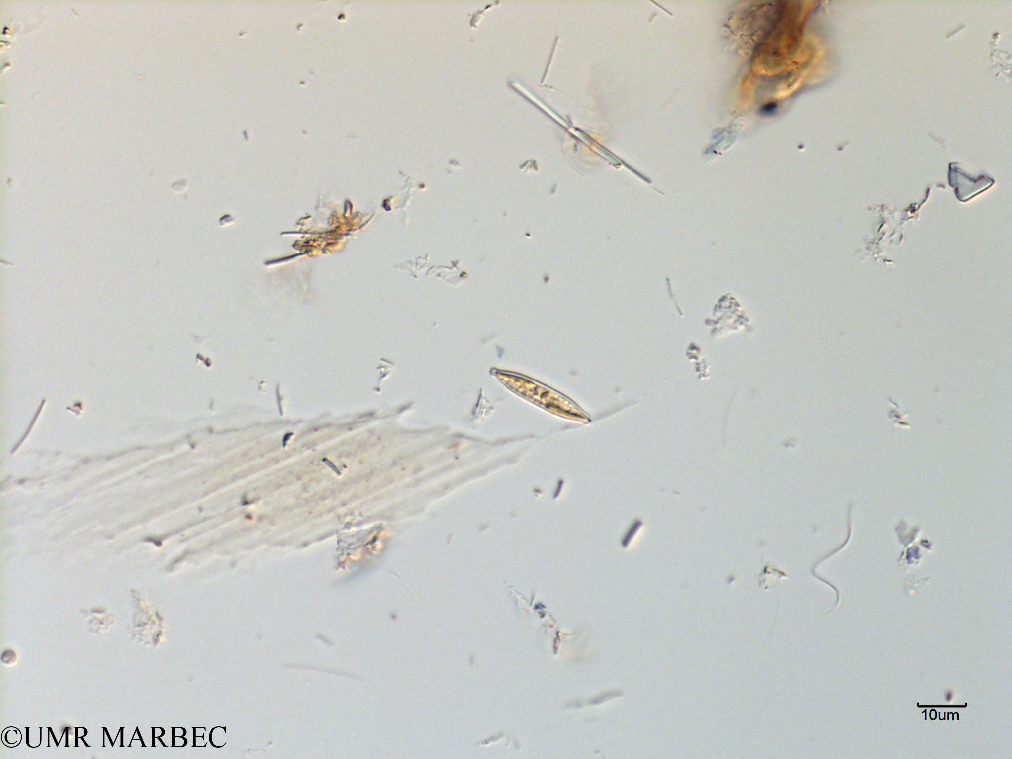 phyto/Scattered_Islands/mayotte_lagoon/SIREME May 2016/Pennée spp 3-5x15-40µm (MAY10_pennee laquelle b-2).tif(copy).jpg